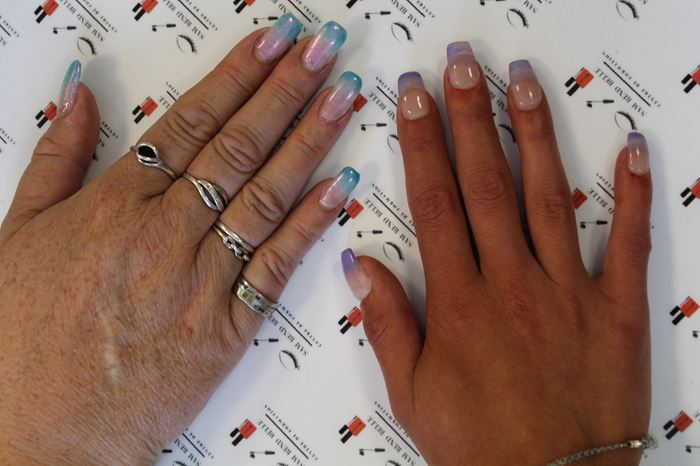 prothesiste ongulaire